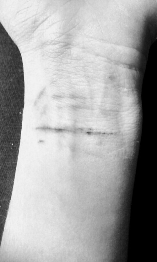 be-cutfree-and-hope:  Follow a depression blog with a little pinch of happiness.