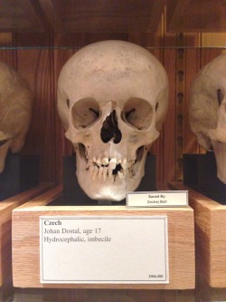 strangebiology:  Odd captions on human skulls at the Mütter Museum in Philadelphia, PA.