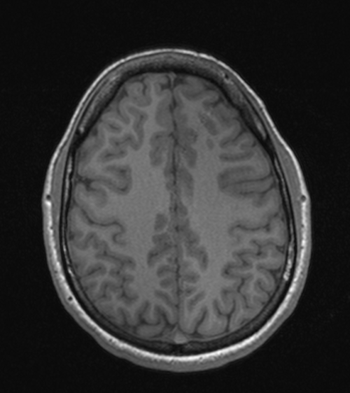 Behold the object of my torment! My dumb stupid brain! From the outside everything looks normal, but once you travel into the depths of the grey squishy folds you’ll find someone very afflicted by torturous contemplation. I feel so abnormal because