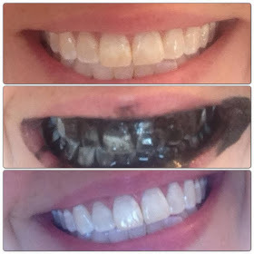 jiagamboa:  Break a capsule in half and use half a capsule to apply to teeth. Brush