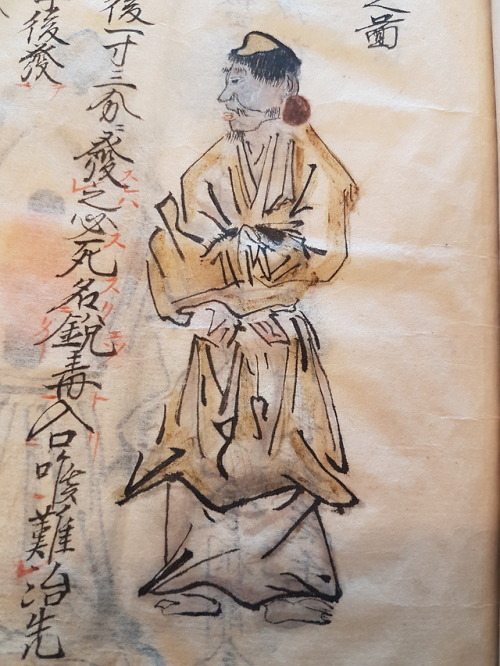 LJS 433 - [Yoso zusetsu]This is a wonderfully illustrated treatise on the diagnosis of abscesses and