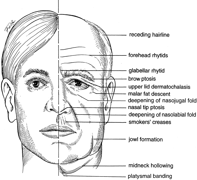 Faith Wong • Anatomy Of Facial Aging My Sculpts Are Based On