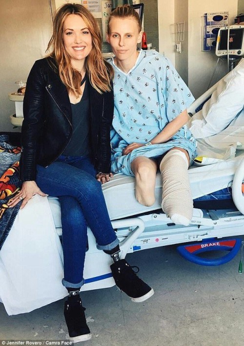 disablebeauty:2 beautiful women = 0 legs I love the bandaged stump.