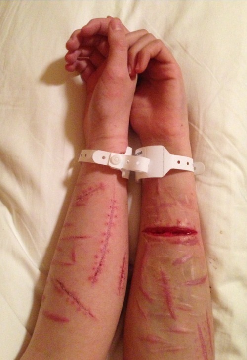 muchozozol:  1 day in my house, 4 days in the hospital. na We Heart It http://weheartit.com/entry/86469399