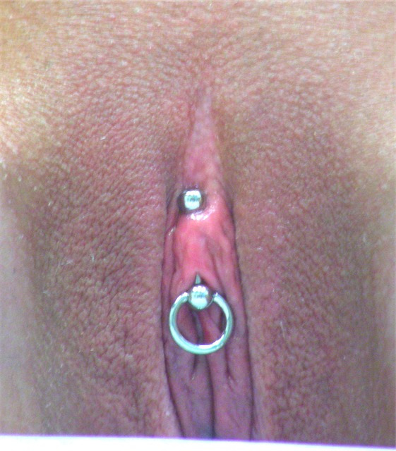VCH