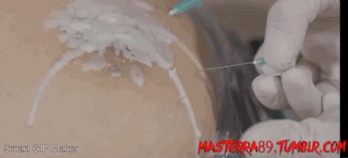 masterra89: As I said in a recent post we have begun producing high quality video