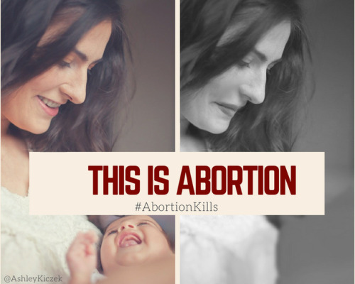 This is Abortion: Abortion destroys Motherhood. #Abortionkills #prolife