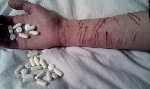 e-jaculatinq:  sadiistic:  skinandbones:  save me  !Soft Perfection!  fucking need