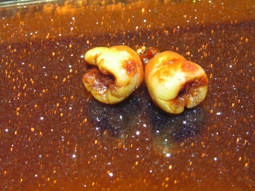 pinxminx7223:  butt-punx:  oH MY GOdD&gt;??? BEAUTIFULLY GROSS MOLAR EARRINGS???!?!