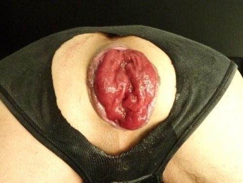 twohandssam:  fuckedupholes:  A bunch of nicely wrecked holes  Worth a repost.