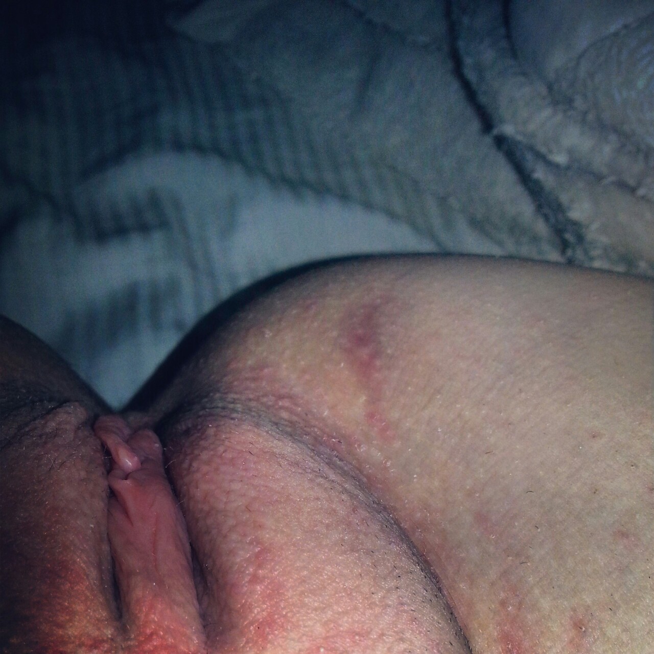 psychoklller:  assessing the damage.. SO RED