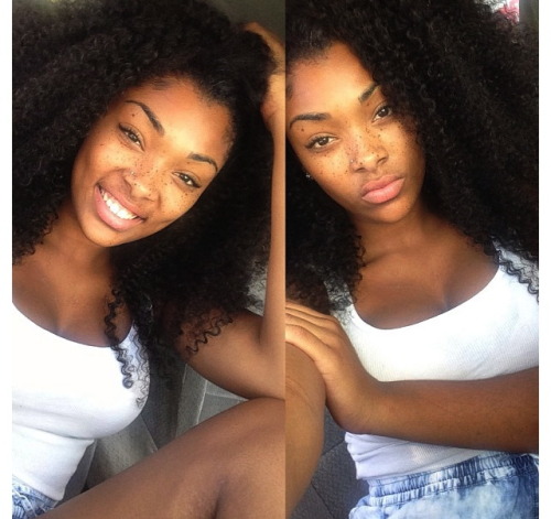 sexy-ass-black-women:  hellyeahstaybeautiful:  hellyeahstaybeautiful  Freckles. 