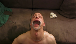 slutmasteruk: A simple dental mouth spreader