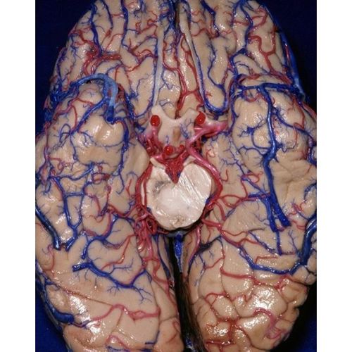 Brain./Cerebro.