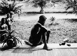 historynet:  A father stares at the hands of his five year-old daughter, which were severed as a punishment for having harvested too little caoutchouc-rubber, Belgian Congo ca., 1900. [700x510]