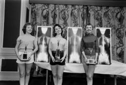 thekhooll:  Chiropractors Beauty Contest by Wallace Kirkland, in the LIFE photo archive 