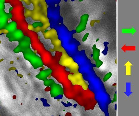 neurosciencestuff:  Motional layers in the brain Recognising movement and its direction