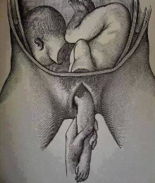 amoresdormidos:  myfuckworld17:  No pongas en el aborto como primera opción , también existe la adopción  que foto tan fuerte :( 
