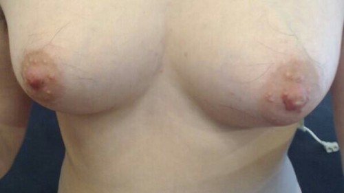 hairyharrietta:#hairynipple porn pictures