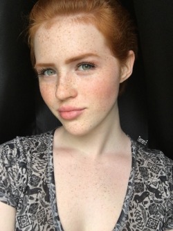 etrue:  I have no earlobe  Such a pretty young lady. #gingers
