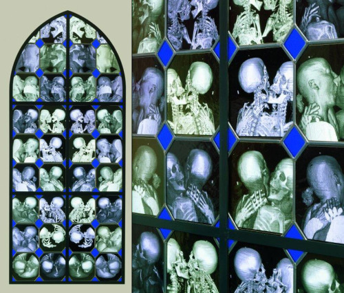 soyonscruels:X-Ray and Anatomical Stained Glass Windows by Wim Delvoye