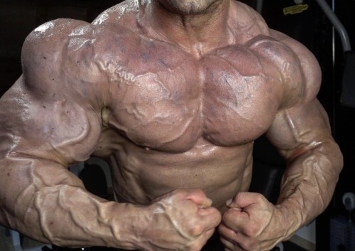 Mattia, Those Delts Are Grotesque. The Vascularity Of Your Forearms Is Disgusting. The Purple Blotches