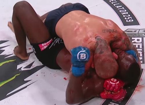 Bloody Fighter Austin Vanderford