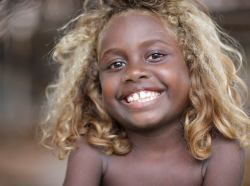 uncivilwar13:  scienceyoucanlove:  Evolution is awesome!  A native group of people living on the Soloman Islands northeast of Australia called Melanesians is famous for their beautiful dark skin and naturally blonde hair. The odd combination has got