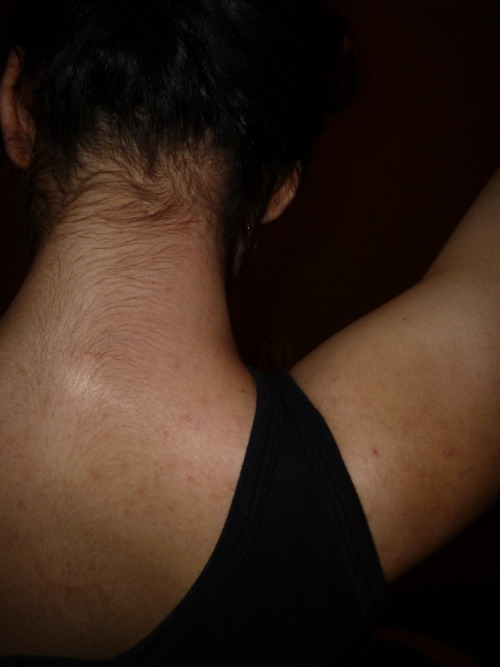 hirsuteandcute: After discovering how many other girls had hair on their stomachs, I thought this wo