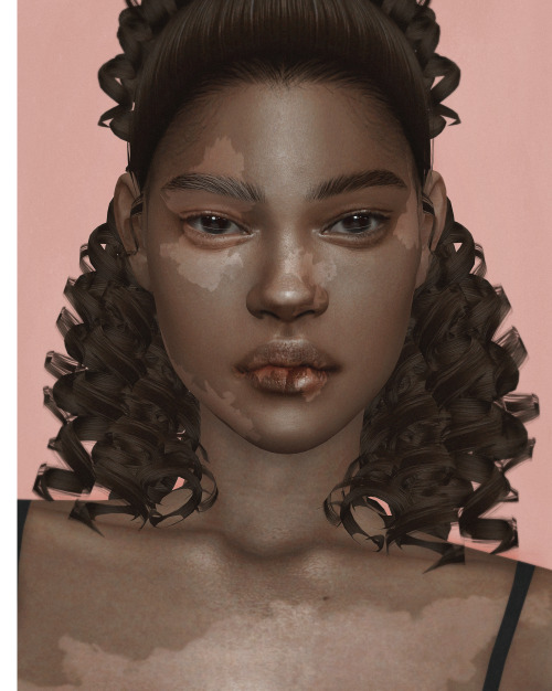 download (ea) \ credits: @ddarkstonee & @obscurus-sims ♡ \ info:sanni skin vitiligo - 5 options 