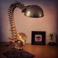 radiopaedia:Spine lamp by Mark Beam. Quite