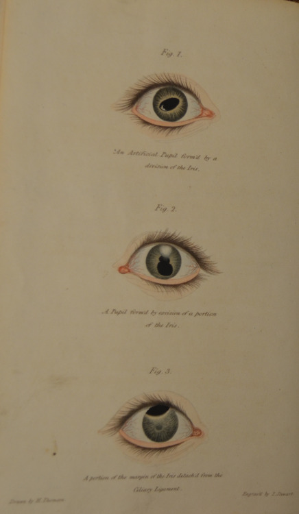 The hand-colored illustrations from early to mid-19th century medical texts are some of the most str