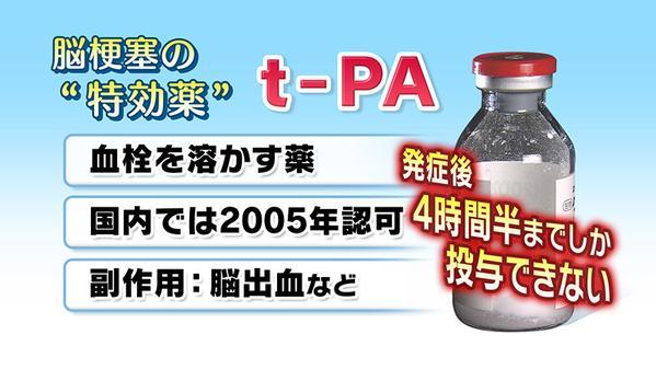 夏場の脳卒中の危険について - Togetterまとめ
熱中症は涼しい場所で身体を冷やして休めば改善することもありますが、脳卒中は #改善しません　。一刻も早く病院での治療が必要な病気です。特に脳梗塞には特効薬が存在しますが、発症後４時間半までしか投与できないそうです。