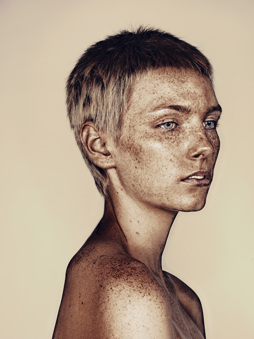 Sex burnagain:  soldsoulglenx:  Amazing Freckles pictures