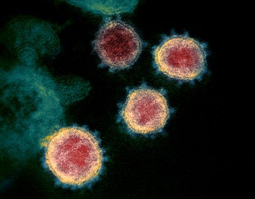 New Images of Novel Coronavirus SARS-CoV-2 Now AvailableHigh-res / Flickr downloadCredit:  NIAI