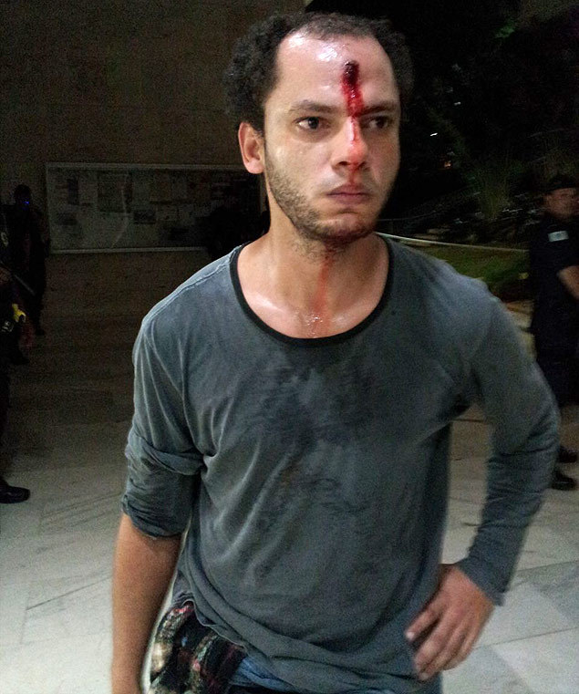 feridosnoprotestosp:  Rodrigo Fernandes, 34, estudante, foi atingido na testa durante