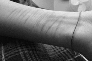 depresiondeadolocentes:  &ldquo;Dejo de doler, pero se ah quedado la marca&rdquo;.