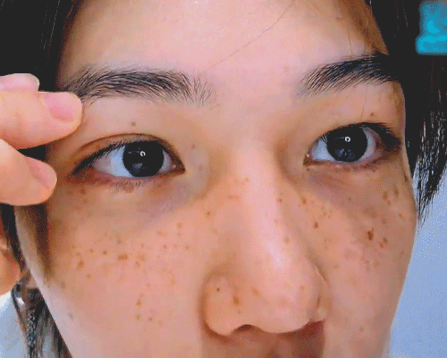 wonstal: some close-ups of felix’s freckles from today’s vlive because…. i’m in love