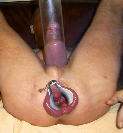 funwithraunch:  prolapse2fuck:  speculum in my prolapse  Speculum seems hardly necessary  MMMM
