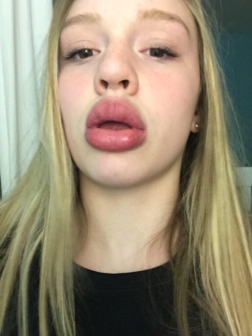 queenruune:  coutois:  soulofanonyx:  The pics you see above were taken from a Twitter hashtag called the #kyliejennerchallenge Funny how black people were caricatured for having big lips & now Kylie Jenner is doing it so its “trendy” kind of