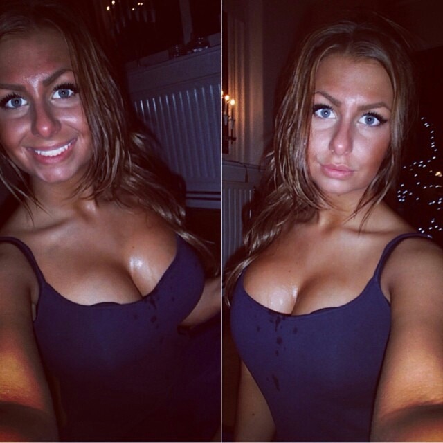 amateur-implant-pics:  @jellydevote