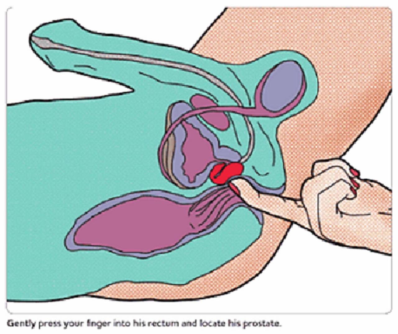 straightmaleanalerotic:  HOW TO GIVE A PROSTATE MASSAGE By WD Before you do anything,