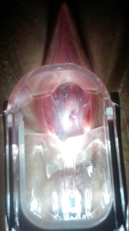 dirty-southeast: Peaches cirvix I&rsquo;d fuck it!