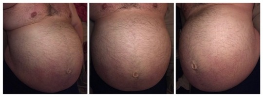 bloatedchowhound:  After 3 days of filling up as full as I can get (literally popping a “button”) the bottom is what I currently look like empty.Hopefully you’ll all get to see this.
