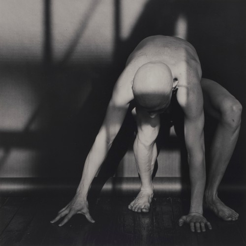 disease:  ROBERT SHERMAN // 1978ROBERT MAPPLETHORPE[gelatin