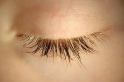 sixpenceee:Poliosis is a condition in which there is a lack of pigment in the hair, eyebrows and eyelashes, which appear whitish, grey. The condition normally occurs in patches. Here are some other rare and rather beautiful conditions mentioned on my