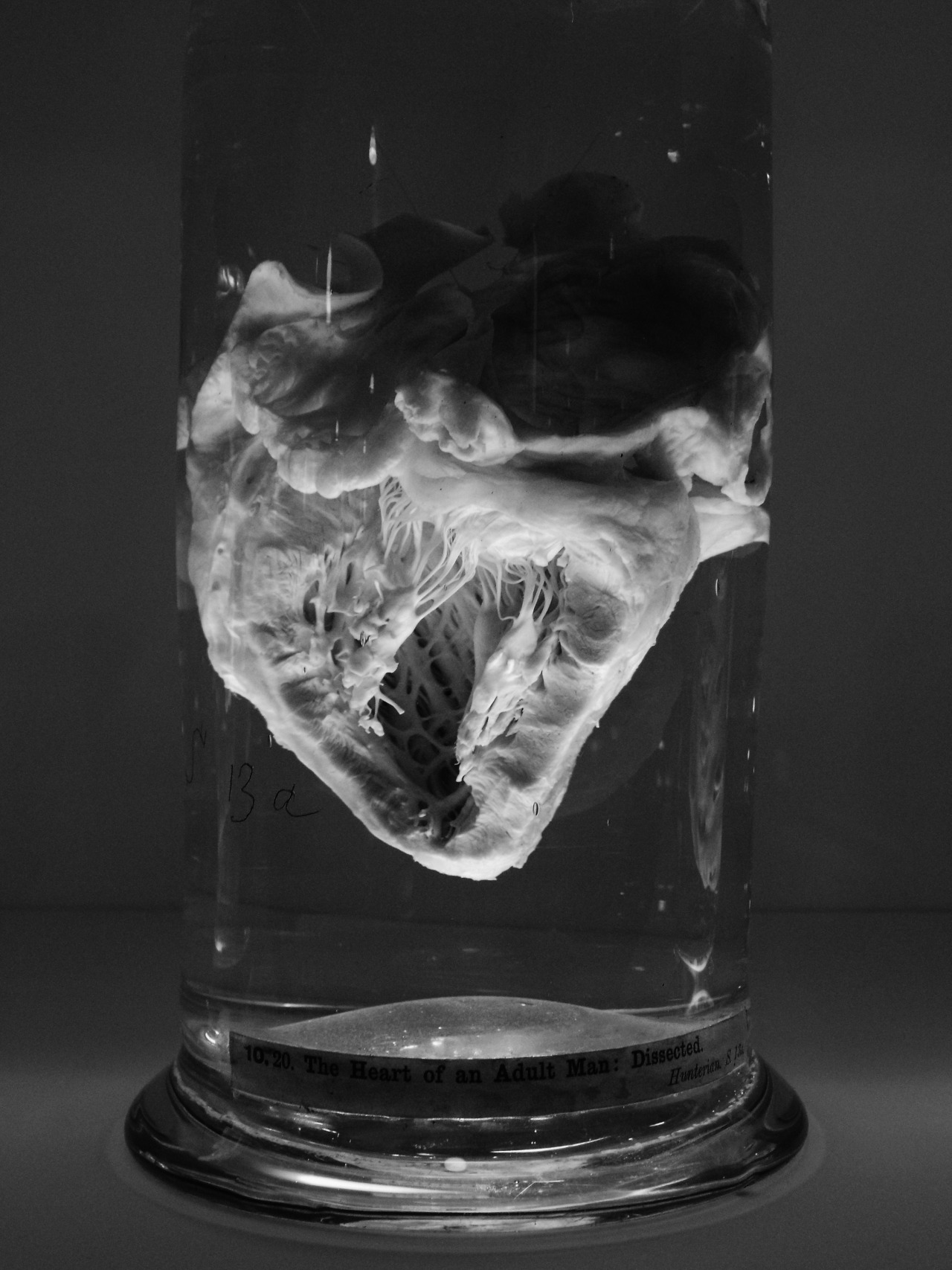 scoutingforghouls:  a man’s heart 