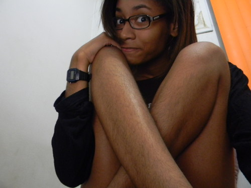 hairylegsclub:  I don’t remember the last time I shaved my legs and I honestly don’t even care! Looks good