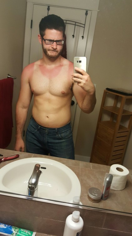 Porn photo eternal-nova:  Got a bit burnt at pride today