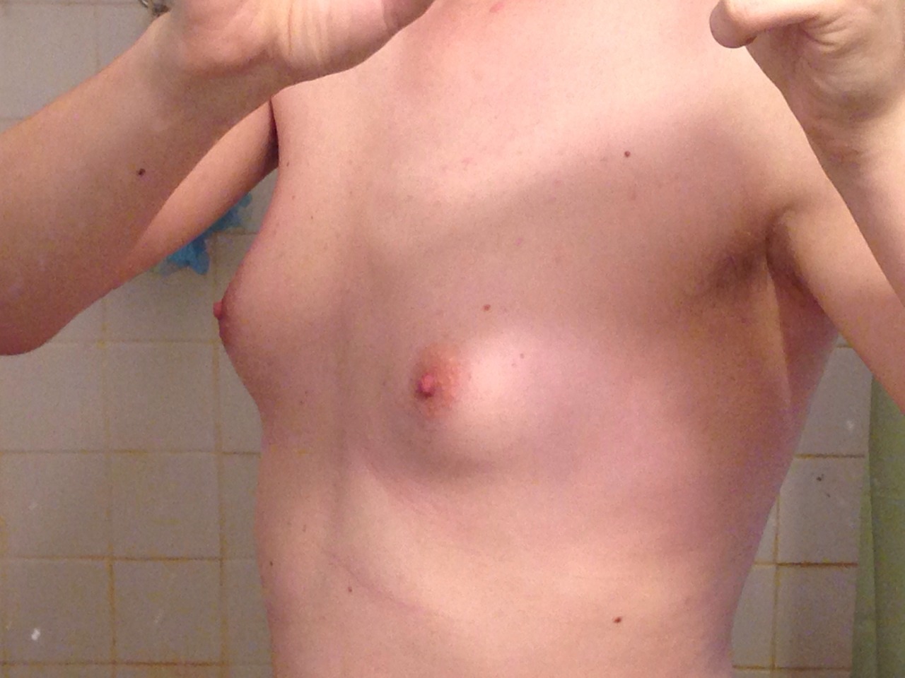 itsstyletrap:  So my tits actually look like tits now and not just cone shaped mounds